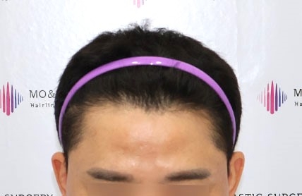 치료후기 이미지